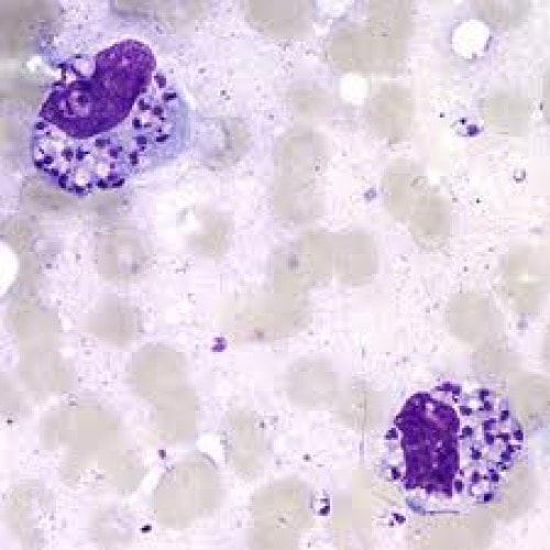 Parasit Leishmania tropica penyebab penyakit kulit