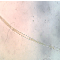 Spyrogyra sp
