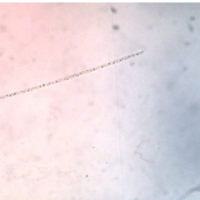 Gonatozygon sp