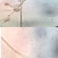 Unidentified Plankton 1