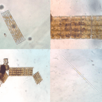 Unidentified Plankton 2