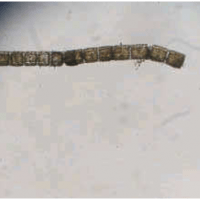 Zygnema sp