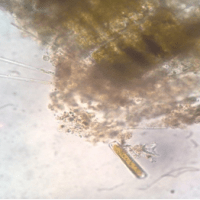 Penium sp