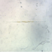 Synedra sp